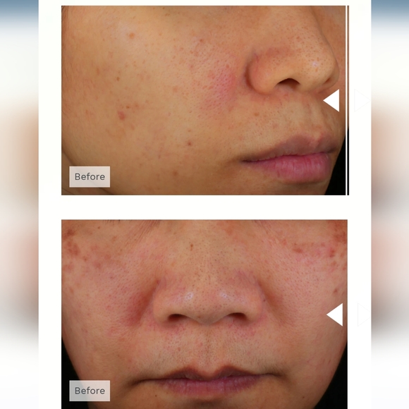 Acaderma's The Oasis Barrier Booster Serum x2 - Picture 8 of 12